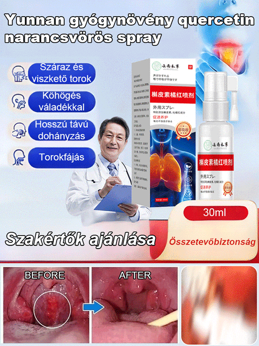 Yunnan gyógynövény quercetin narancsvörös spray