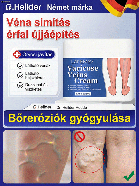 A láb visszér ápoló krém